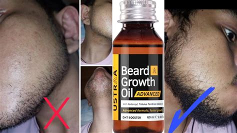 Ustraa Beard Growth Oil Advanced Full Review Youtube