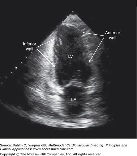 Echocardiography Radiology Key