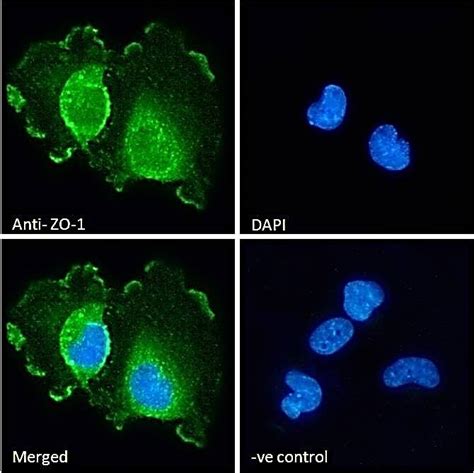 Tight Junction Protein Antibody Nbp By Novus Part Of Bio Techne