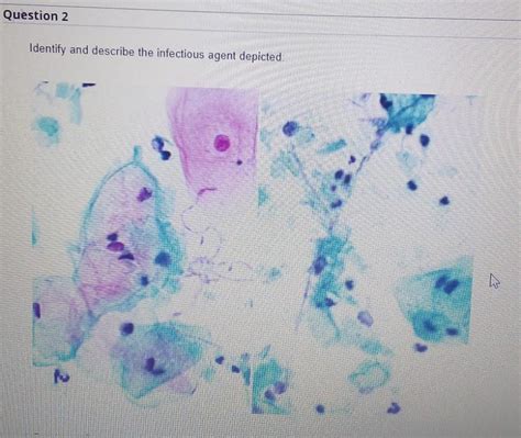 Solved Identify and describe the infectious agent depicted | Chegg.com