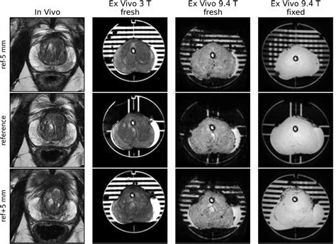 Frontiers Apparatus For Histological Validation Of In Vivo And Ex