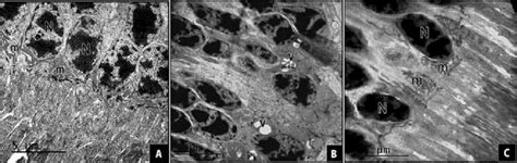 Electron Micrographs Of Outer Nuclear Layer Onl A Control Group