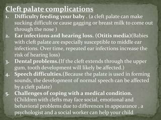 Cleft palate dental oral pathology | PPT