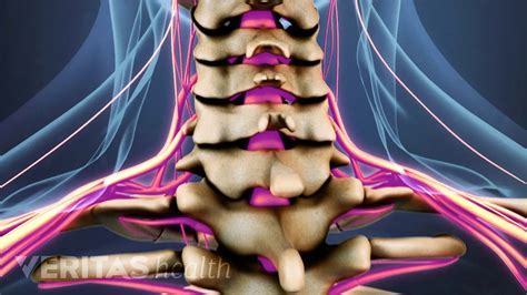 Cervical Spinal Nerves Diagram