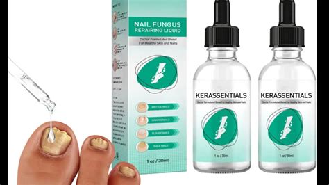 Dr Langdon Toenail Fungus :- Dr Kimberly Langdon Fungal Treatment Reviews!