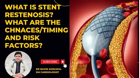 WHAT IS STENT RESTENOSIS WHAT ARE THE CHNACES TIMING AND RISK FACTORS