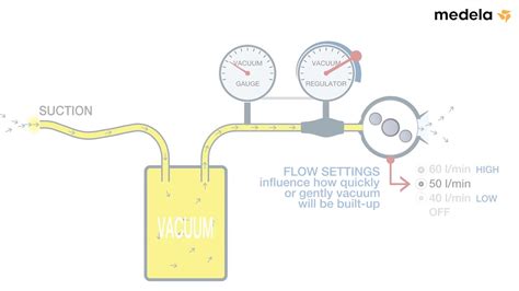 Medela Dominant Flex Telegraph