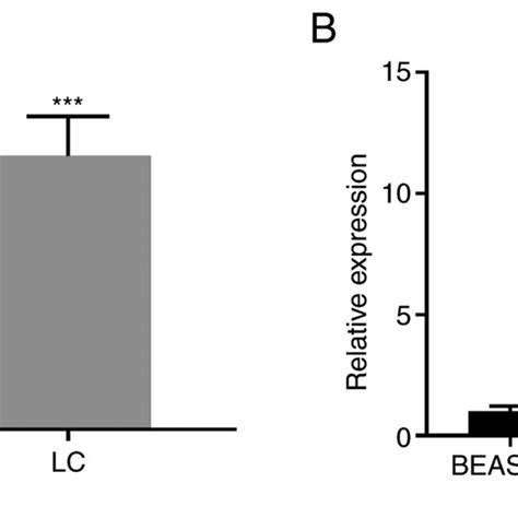 LINC00887 Is Upregulated In LC Tissues And Cell Lines A Expression