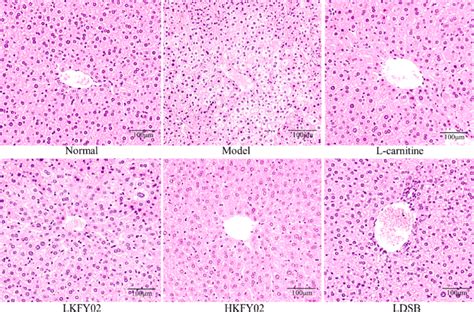 Observation Of Pathological Changes In Mouse Liver By Hematoxylin Oesin