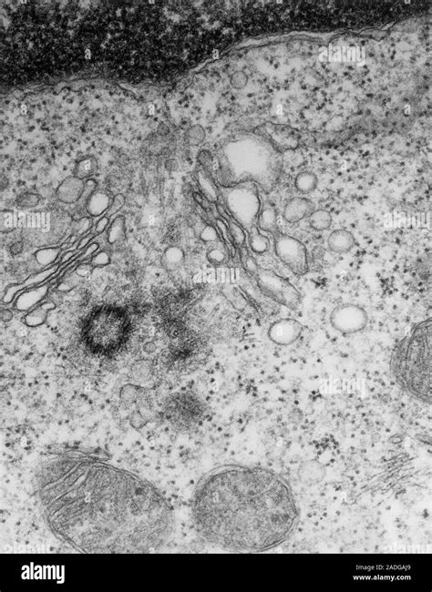 Golgi Apparatus Transmission Electron Micrograph Of A Golgi Apparatus