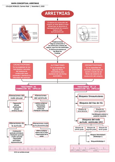 Mapa Conceptual Arritmias Arritmias Cardiacas Arritmias Udocz