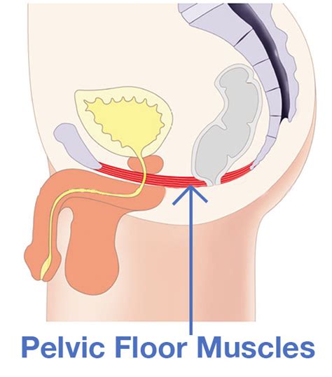 Erectile Dysfunction Treatment Emsella Chair For Ed