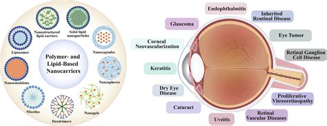 Polymer And Lipid Based Nanocarriers For Ocular Drug Delivery Current