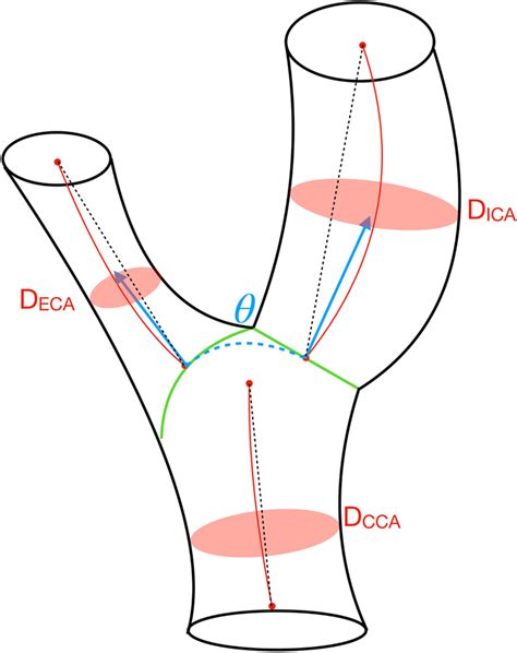 Schematic Of The Carotid Artery Bifurcation Green Lines Depict