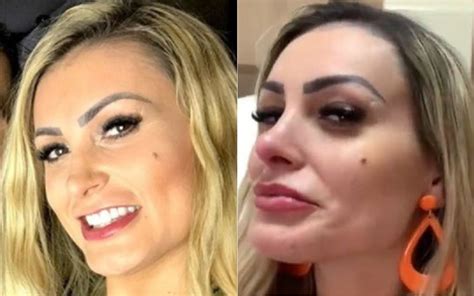 Andressa Urach mostra como era antes da fama e choca É cirurgia