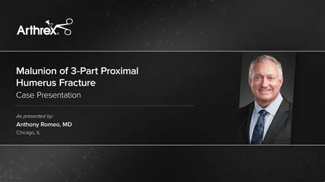 Arthrex Malunion Of 3 Part Proximal Humerus Fracture