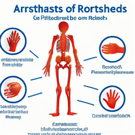 Understanding Psoriatic Arthritis Symptoms: A Comprehensive Guide - The ...