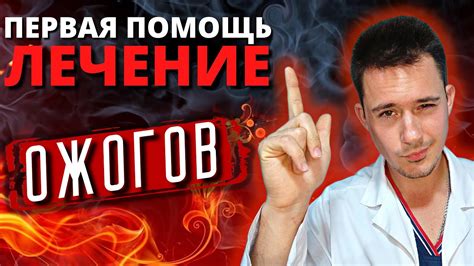 Ожоги | Первая помощь при ожогах | Лечение ожога - YouTube