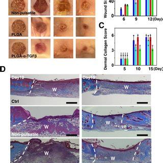 Delivery of TGFβ inhibitor with PLGA NB capsules can enhance skin wound