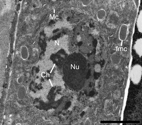 Ditylenchus Arachis Spermatocyte From The Male Testis Tem