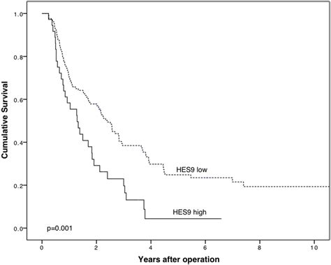 High PODXL Expression By Monoclonal Antibody HES9 Is A Marker Of Poor