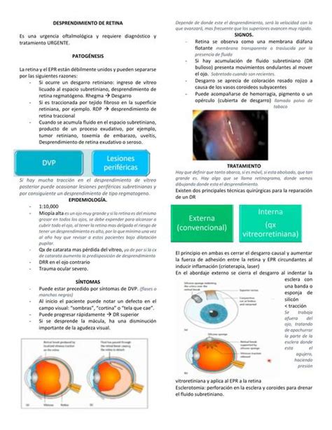 Desprendimiento De Retina Mariana Navarro De La O UDocz