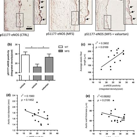 Valsartan Treatment Rescues Phosphoenos Expression In The Aorta Of Mfs