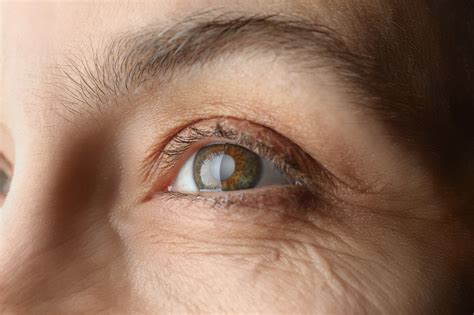 How Do You Know When To Have Cataract Surgery Eye Center Of Texas