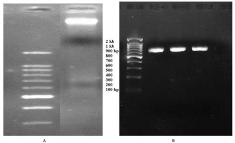 A Photograph Showing Genomic DNA Band In 1 Agarose Gel B