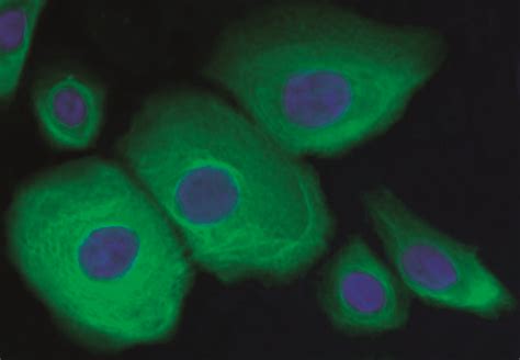 Normal Human Epidermal Keratinocytes Nhek Promocell