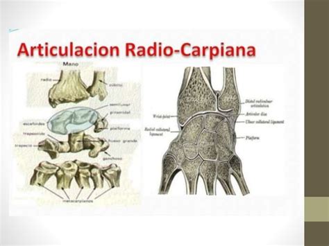 Fracturas De Radio Distal Ppt