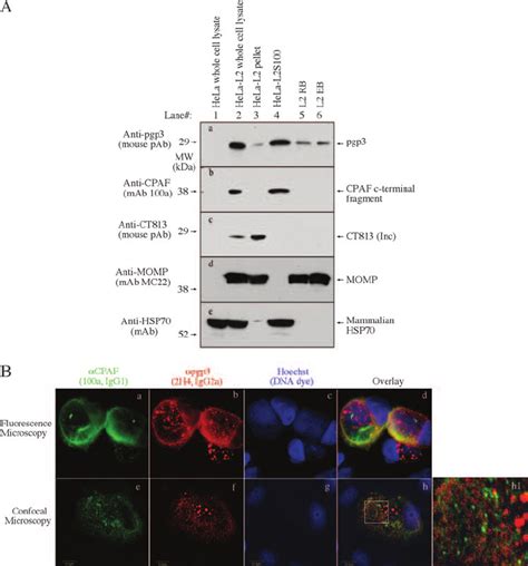 Pgp Is A Unique Secretion Protein A Hela Cells Infected With C