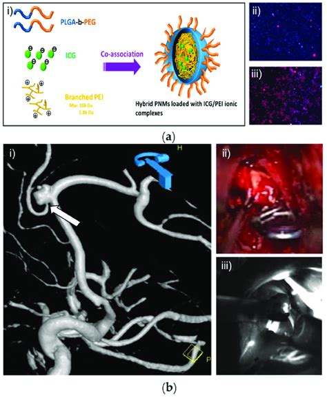 ICG Encapsulated Nanoparticles For Biomedical Applications A