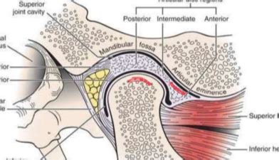 Ocs Prep Orofacial Pain Flashcards Quizlet