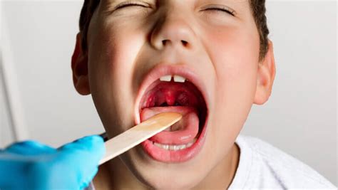 Secret behind white spots on tonsils - Fit Netion