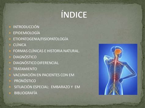 2017 03 03esclerosis Multipleppt