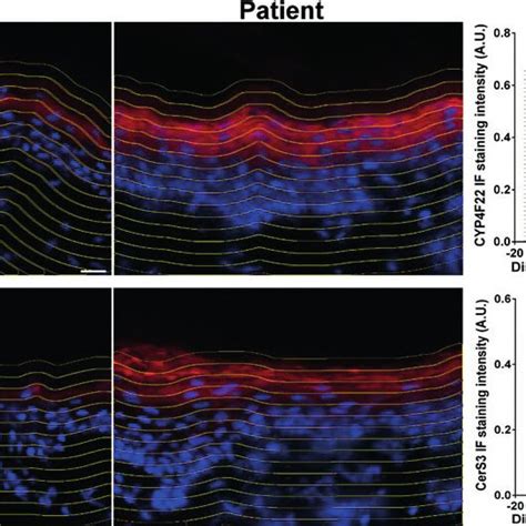 Examples Of Immuno Fluorescence Staining Left And Cellprofiler