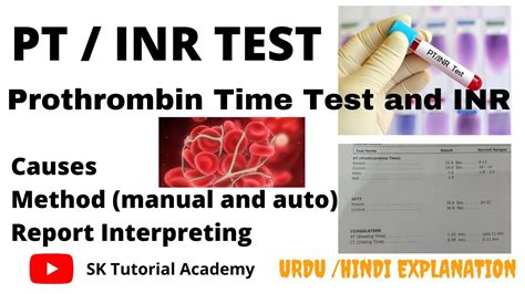 Pt Inr Test Prothrombin Time Test YouTube