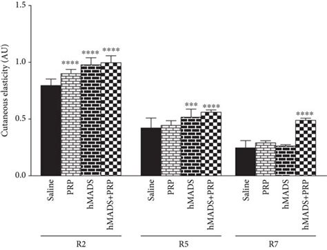 PRP Treatment Improves The Healing Potential Of Human MSC HMADS Cells