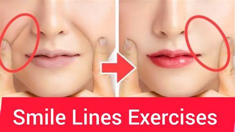 5 Minutes Smile Lines Facial Exercises Nasolabial Folds Lift Laugh