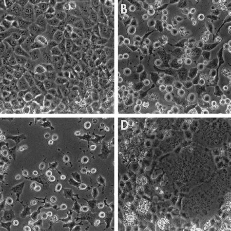 VSV-RSV F causes syncytia formation. Virus-induced cytopathic effects ...