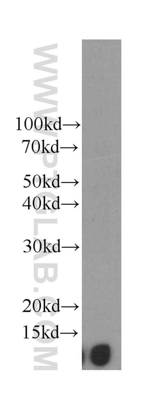 Beta 2 Microglobulin Mouse Anti Human Clone 1c3b7 Proteintech 20 μl