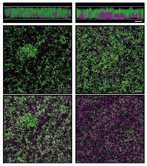 The Hidden Lifestyle Bacterial Diversification In The Biofilms Nature Portfolio Microbiology