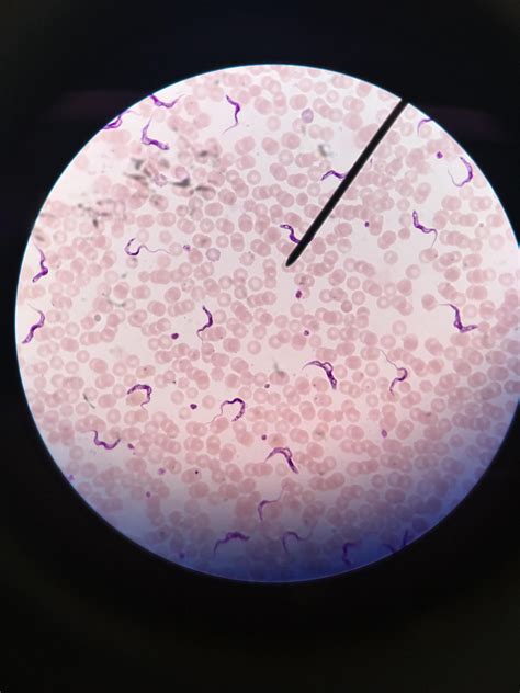 Blood morphology – Artofit