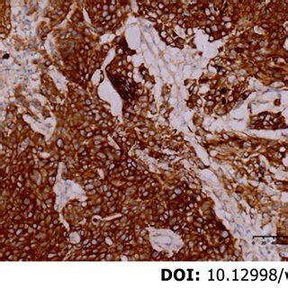 Immunohistochemical Staining Of Cdx Ck Ck And P A The Cancer