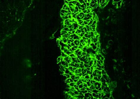 Anti-Endomysial antibodies (AEA) positive control - Launch Diagnostics