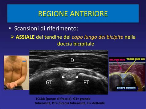 PPT ANATOMIA PER IMMAGINI DELLA SPALLA ECOGRAFIA PowerPoint