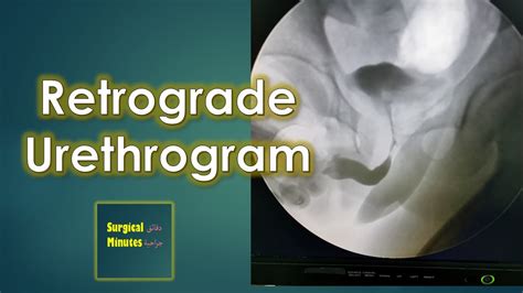 Retrograde Urethrogram Rug Live Video Youtube