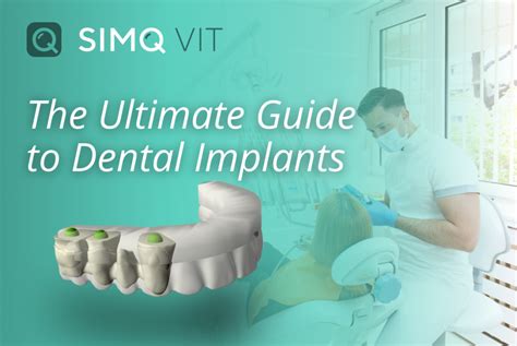 Dental Implant Workflow Incorporating Digital Tech Simq