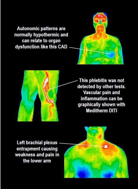 Full Body Scans Dynamic Thermal Imaging